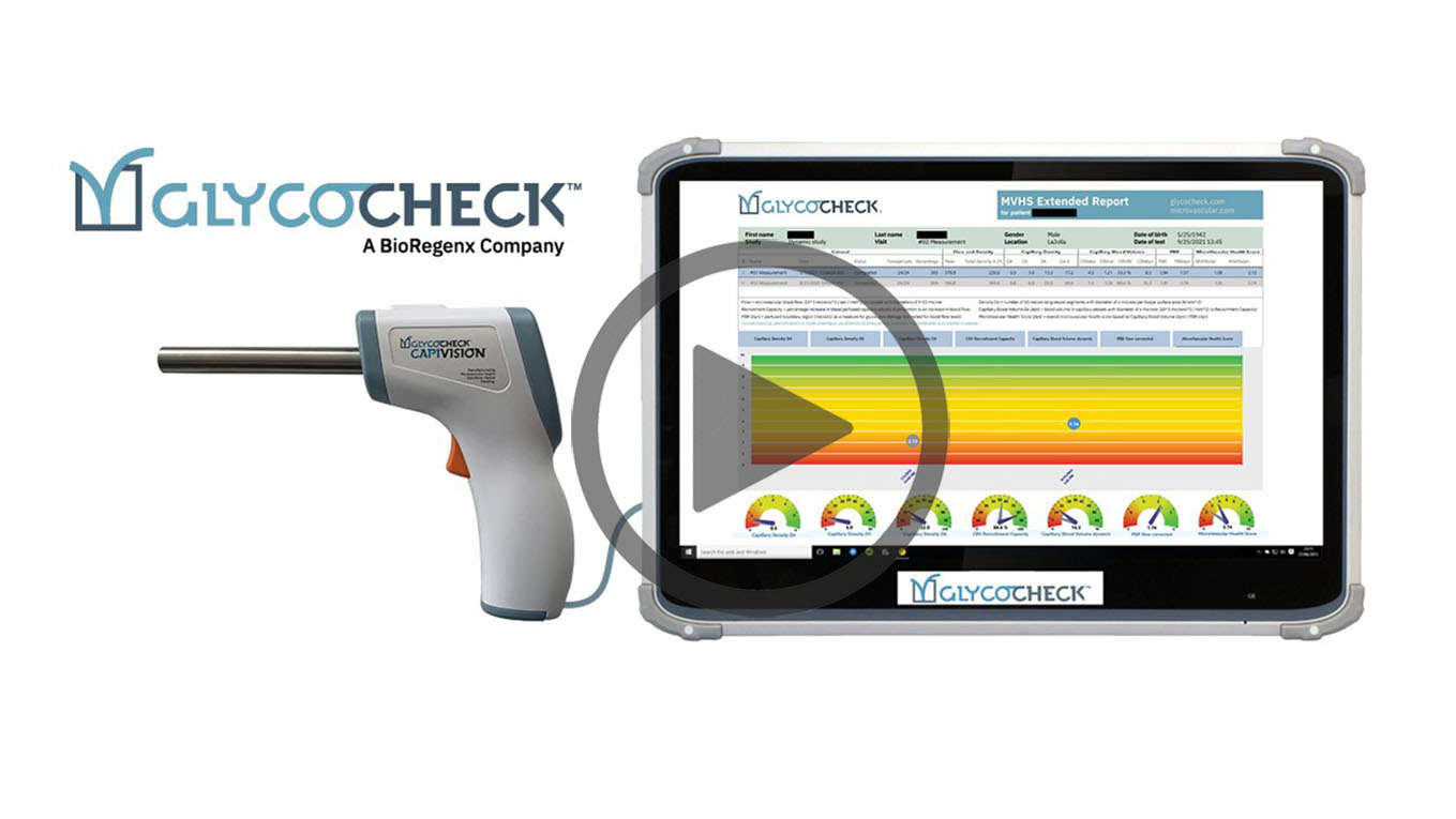Glycocheck system image thumbnail with play button